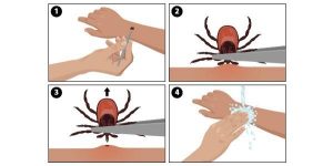 health_department_-_ticks_are_bad_graphic