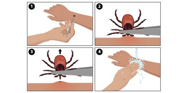 health_department_-_ticks_are_bad_graphic